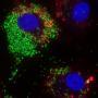 Brucella abortus (green) in THP-1 cells stained for acidic vesicles (red).